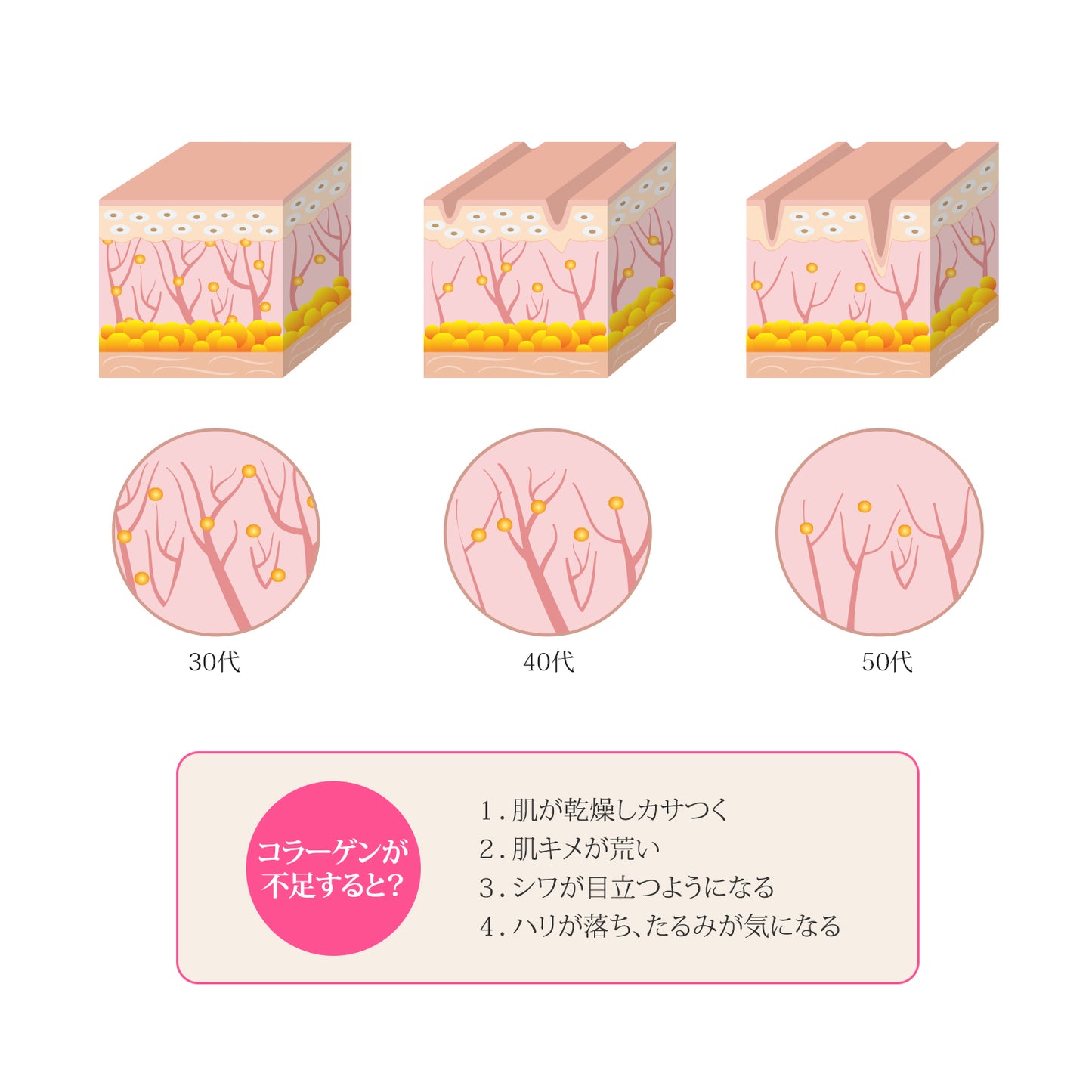 エルツティン EXプレステージセラム(8ml×4個)