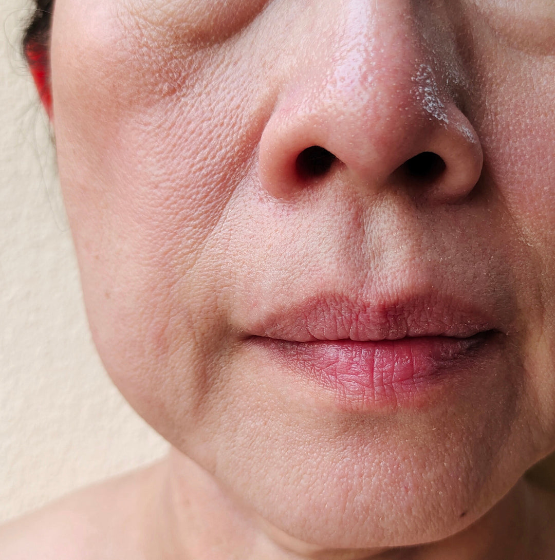 ハリ・弾力・たるみ